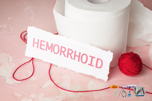 Illustrazione emorroidi e trattamento